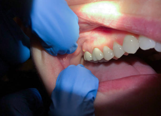 Best Emergency Dental Services for Seniors in Addison, WV