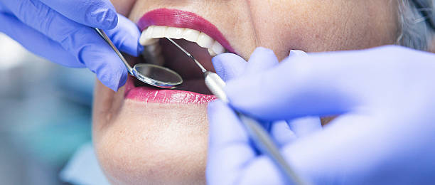 Best Emergency Root Canal Treatment in Addison, WV