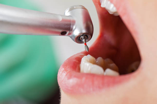 Best Emergency Root Canal Treatment in Addison, WV